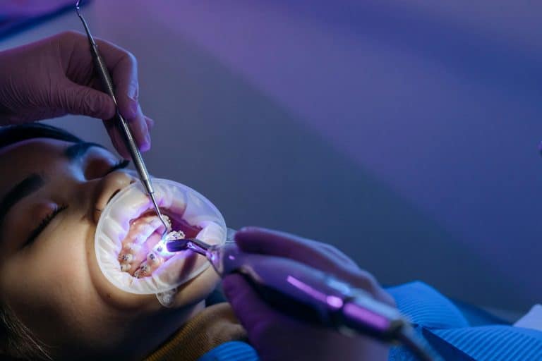 What’s the Best Age to Start Orthodontic Treatment in North Vancouver